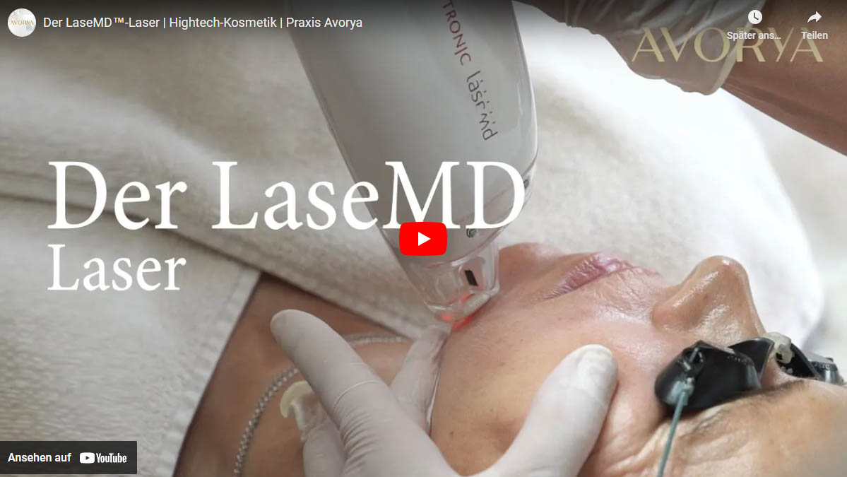 Der LaseMD™-Laser, Laserbehandlung Hautverjüngung