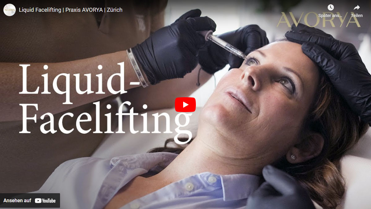 Liquid Facelifting - Praxis AVORYA in Zürich