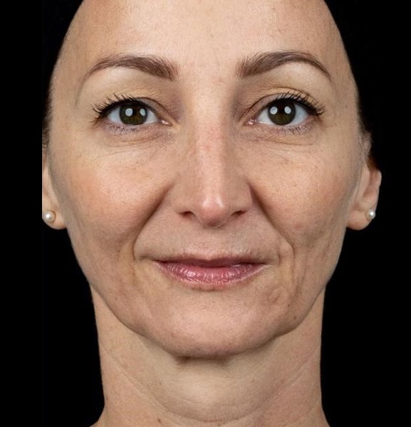 AVORYA Zürich